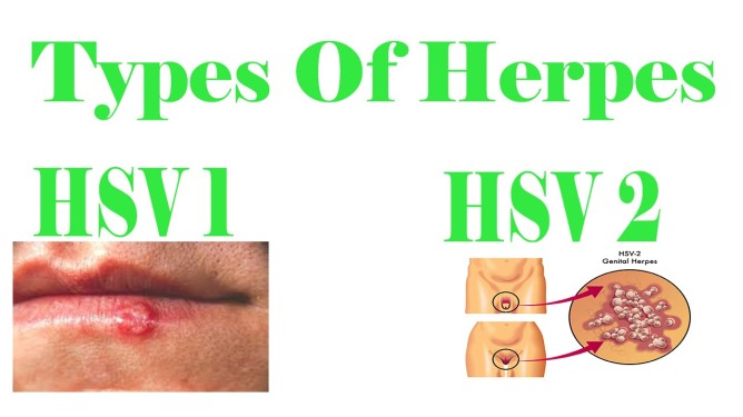 herpes-type